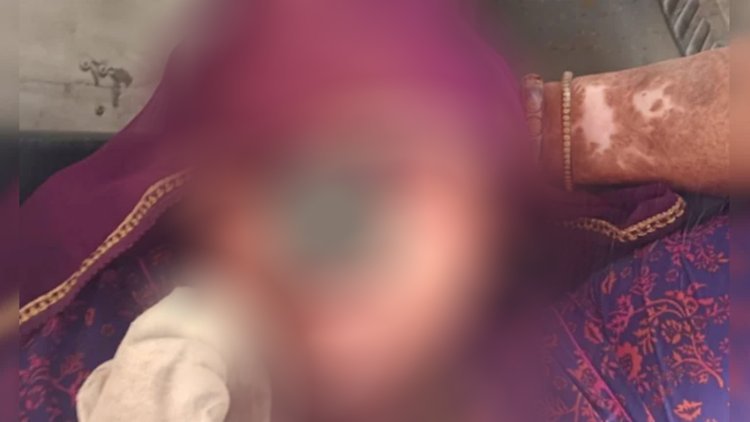 दामाद ने कैंची से काटी सास की नाक, कटा हिस्सा लेकर हुआ फरार